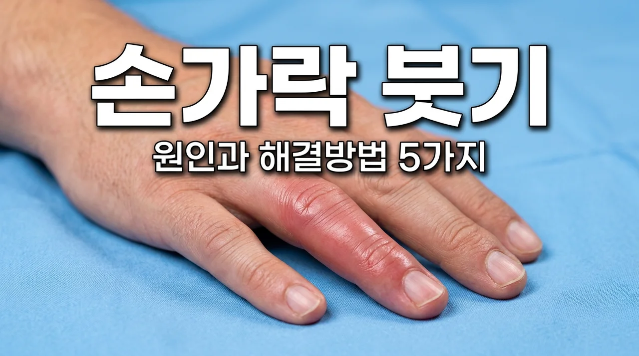 손가락 부었을때 원인 5가지와 즉각적인 붓기 완화 방법 총정리