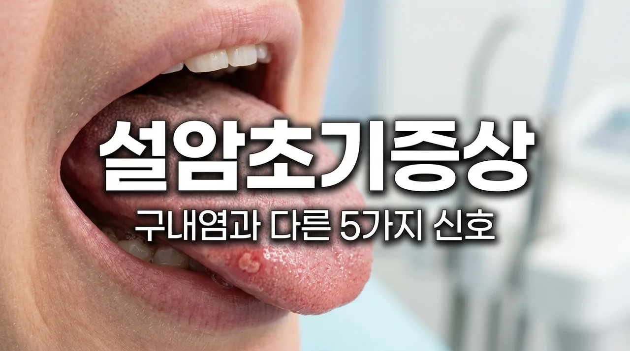 설암초기증상 5가지와 구내염 차이점, 2주 넘으면 꼭 확인하세요