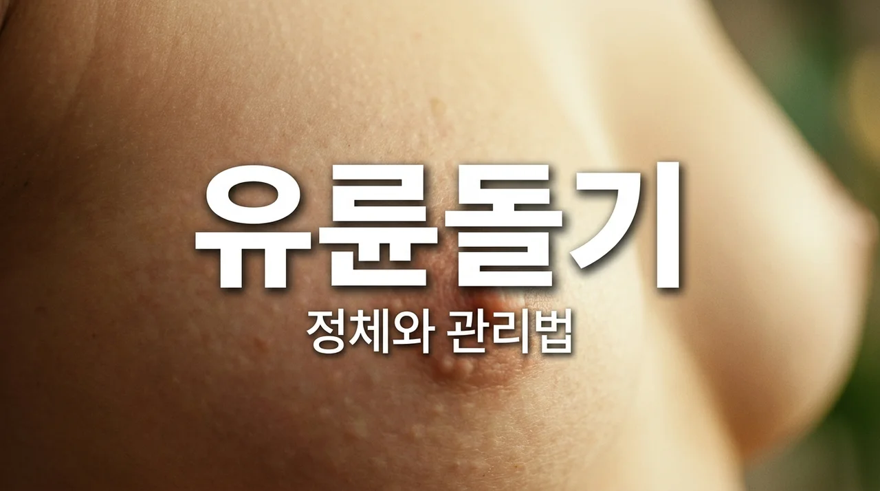 유륜돌기, 몽고메리결절 정체 파헤치기! 제거보단 관리법부터